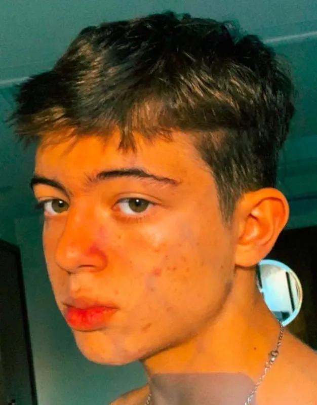 Resultado 5 meses antes