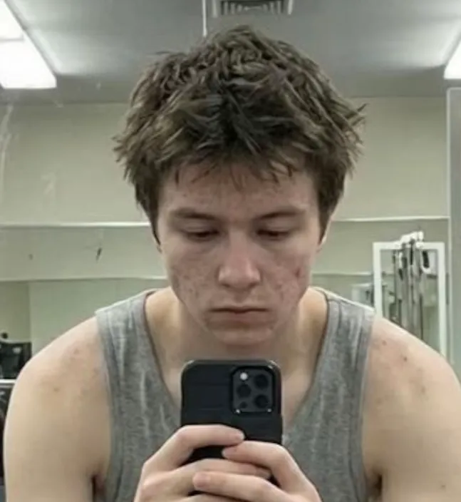 Resultado 4 anos antes